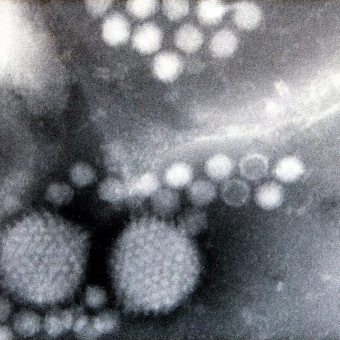Rotavirus B electron micrograph