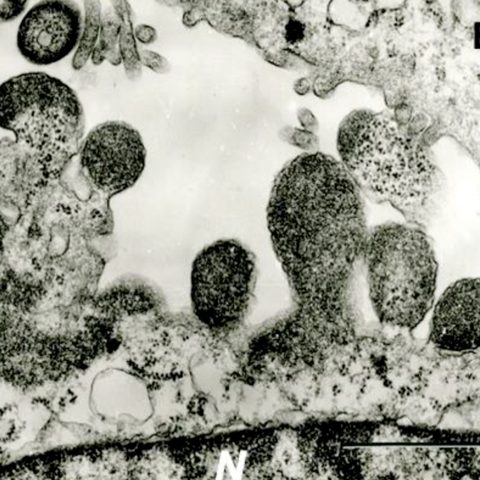 Ross River virus electron micrograph