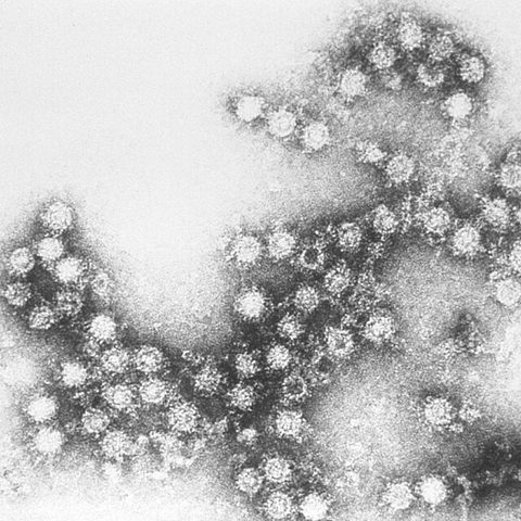 Macacine herpesvirus 1 (B virus) electron micrograph