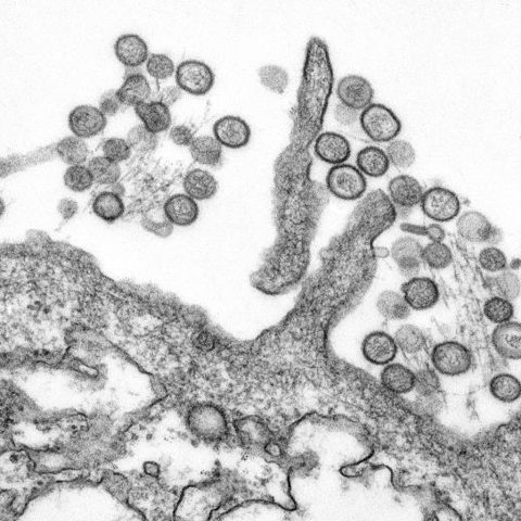 Poliovirus 1 electron micrograph