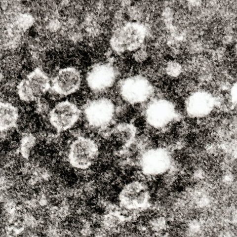Chandipura virus electron micrograph
