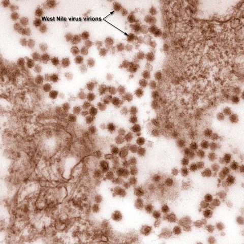 Human herpesvirus 6B electron micrograph