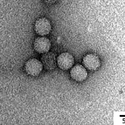 Rotavirus C electron micrograph