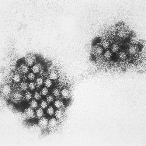 Human coronavirus OC43 electron micrograph