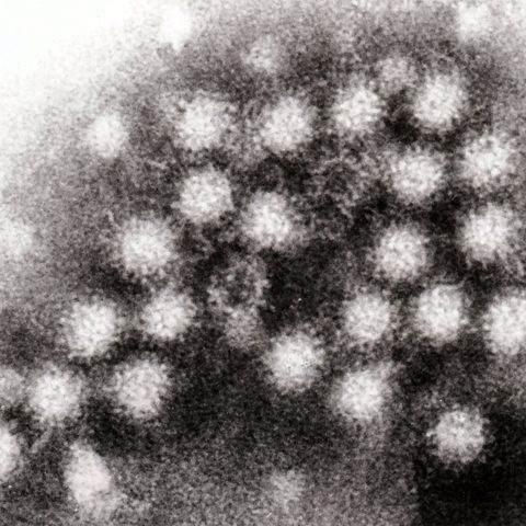 Newcastle disease virus electron micrograph