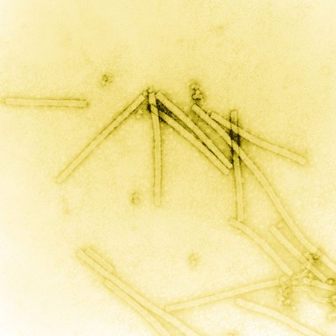 Rabies virus electron micrograph