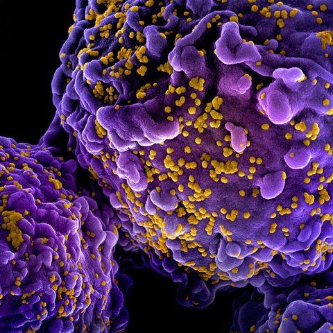 Japanese encephalitis virus electron micrograph