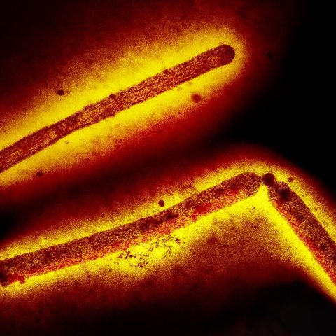 Sindbis virus electron micrograph