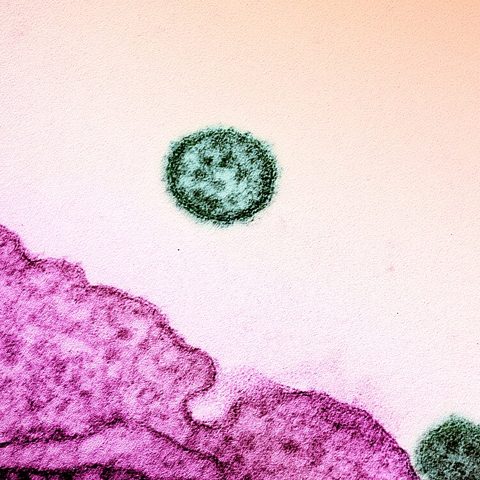Influenza A H5N8 electron micrograph