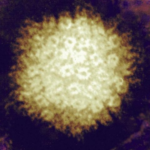 Reston virus electron micrograph