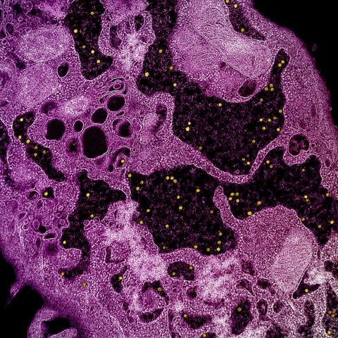 Bundibugyo virus electron micrograph
