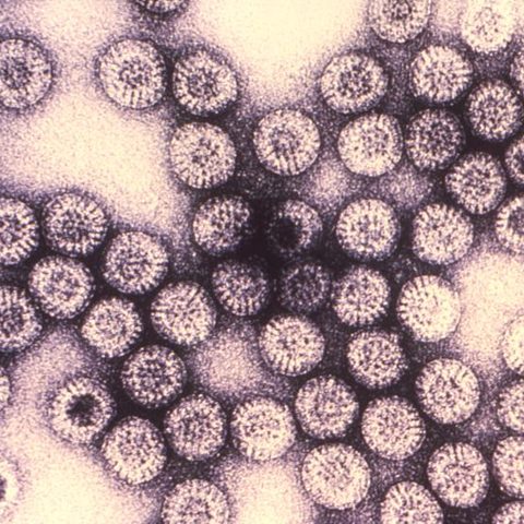 Human parainfluenza virus 4 electron micrograph