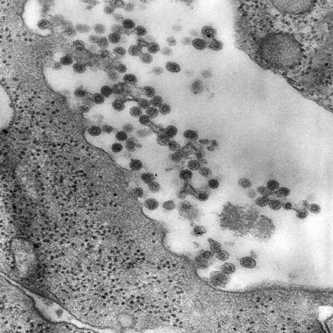 Rhinovirus A electron micrograph