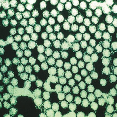 Australian bat lyssavirus electron micrograph