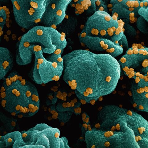 St. Louis encephalitis virus electron micrograph