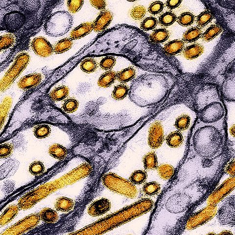 Mayaro virus electron micrograph