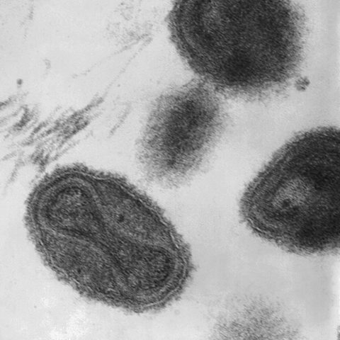 Enterovirus A71 electron micrograph