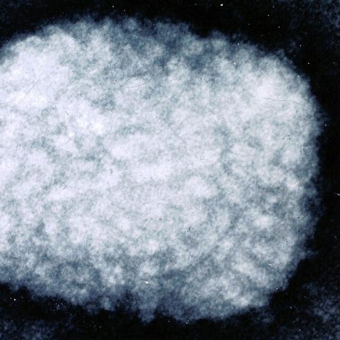 Poliovirus 3 electron micrograph