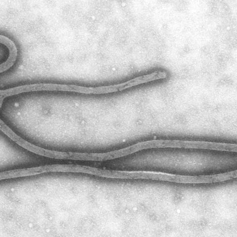 Kyasanur Forest disease virus electron micrograph
