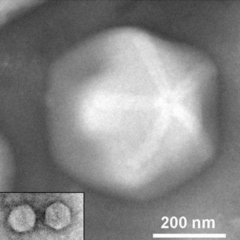 Respiratory syncytial virus B electron micrograph