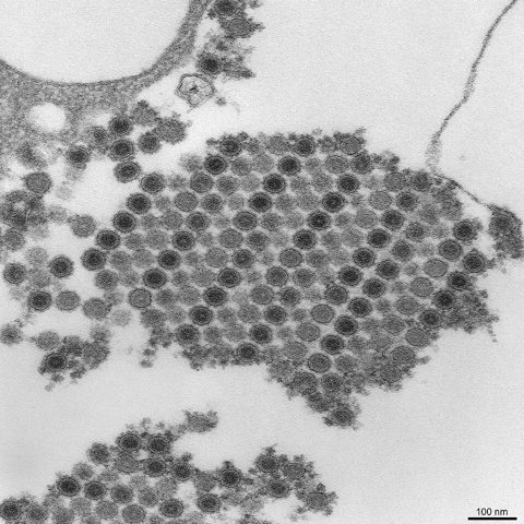Taï Forest virus electron micrograph