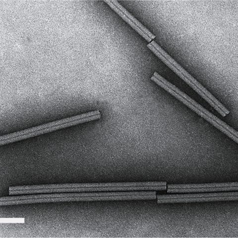 Lagos bat virus electron micrograph