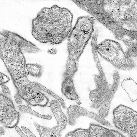 Kaposi's sarcoma herpesvirus electron micrograph