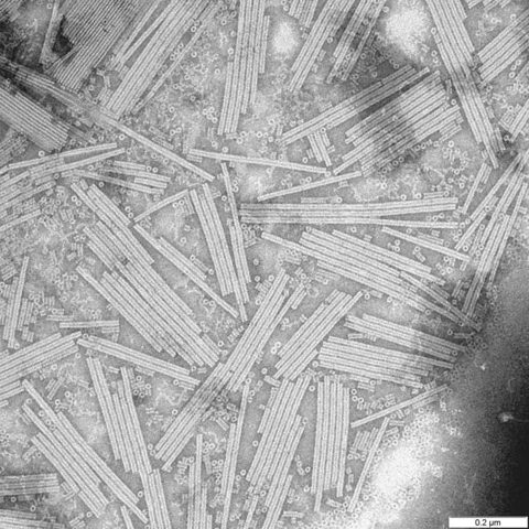 Influenza B Yamagata electron micrograph