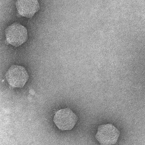 Canine distemper virus electron micrograph