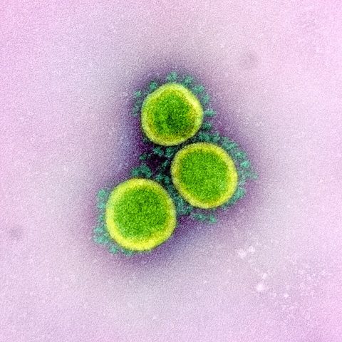 Human astrovirus electron micrograph