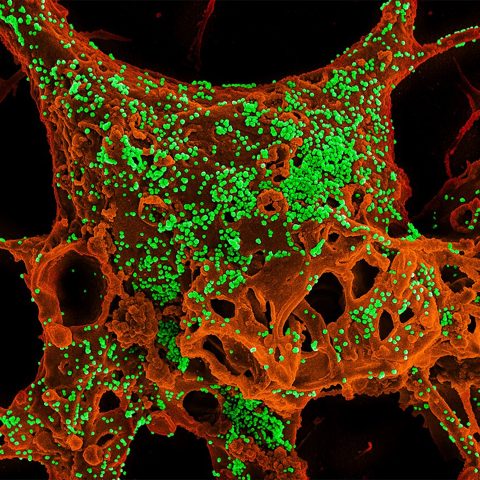 MERS-CoV electron micrograph