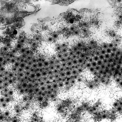 Mokola virus electron micrograph
