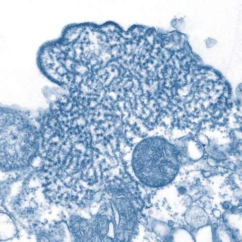 Hepatitis C virus electron micrograph