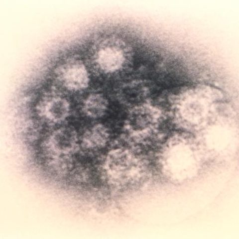 Hepatitis D virus electron micrograph