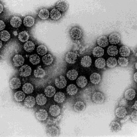 Rhinovirus C electron micrograph