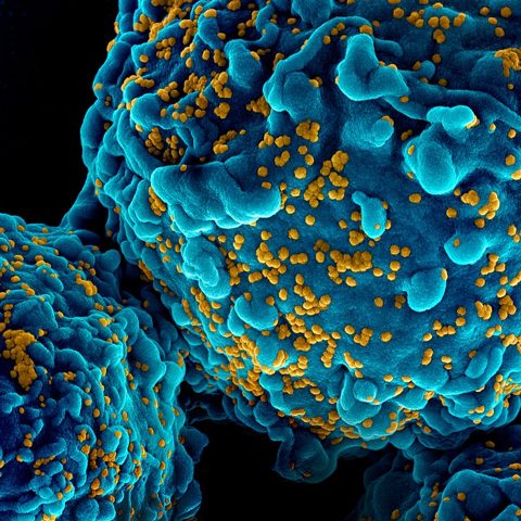 West Nile virus electron micrograph