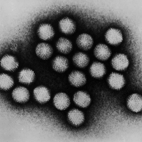 Hepatitis E virus electron micrograph