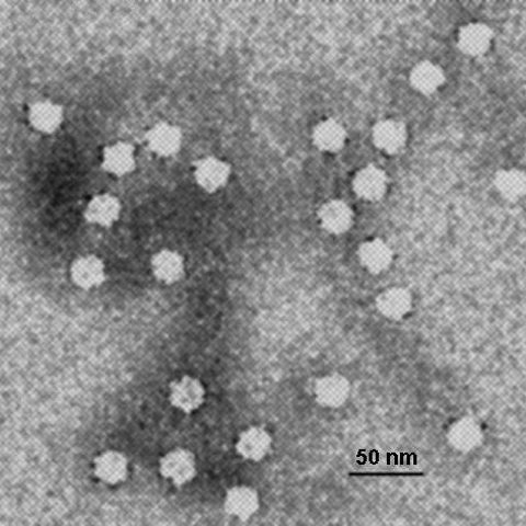 Vesicular stomatitis virus electron micrograph
