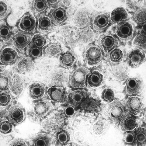 Murray Valley encephalitis virus electron micrograph