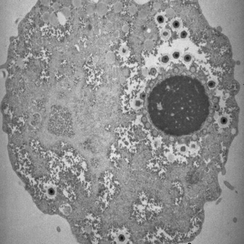 Human metapneumovirus electron micrograph