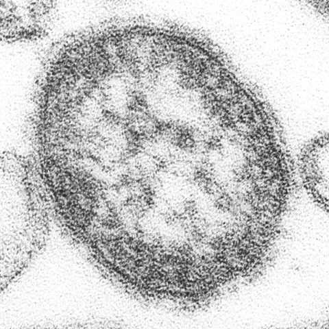 Human coronavirus HKU1 electron micrograph