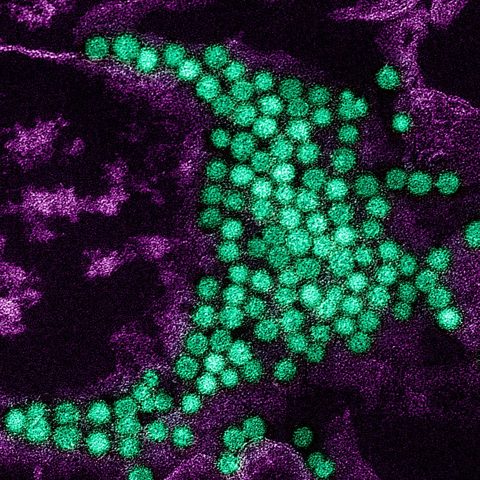 Poliovirus 2 electron micrograph