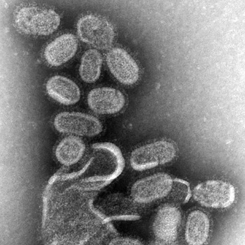 Rinderpest virus electron micrograph
