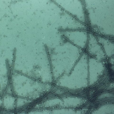 Hendra virus electron micrograph