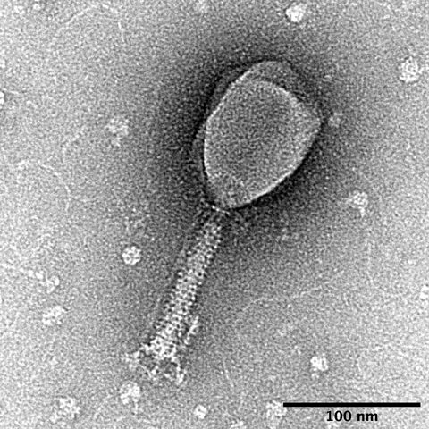 Influenza A H5N1 electron micrograph