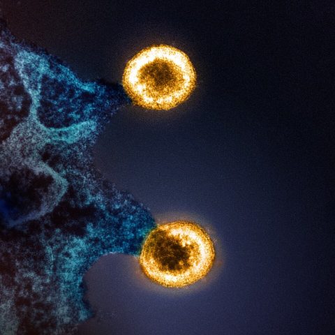 Powassan virus electron micrograph