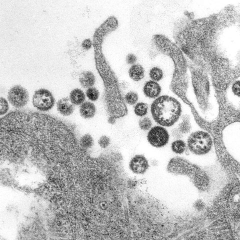 Venezuelan equine encephalitis virus electron micrograph