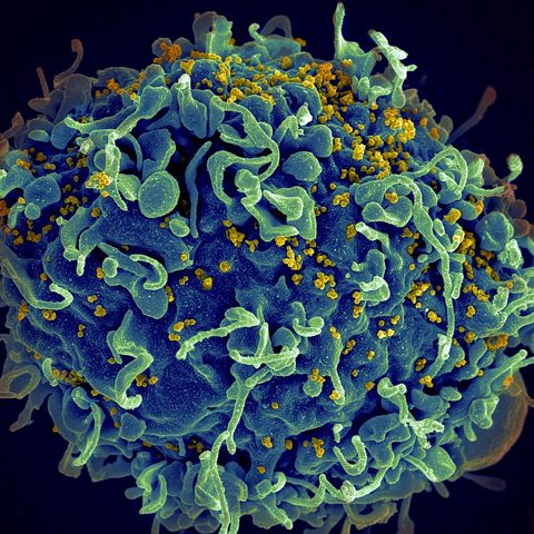 Simian immunodeficiency virus electron micrograph