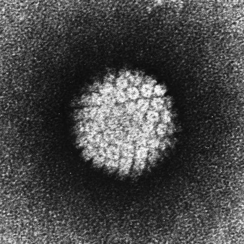 Dengue virus 4 electron micrograph
