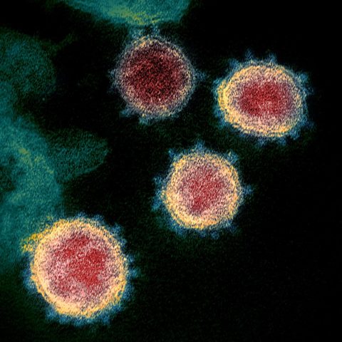 Sapovirus electron micrograph